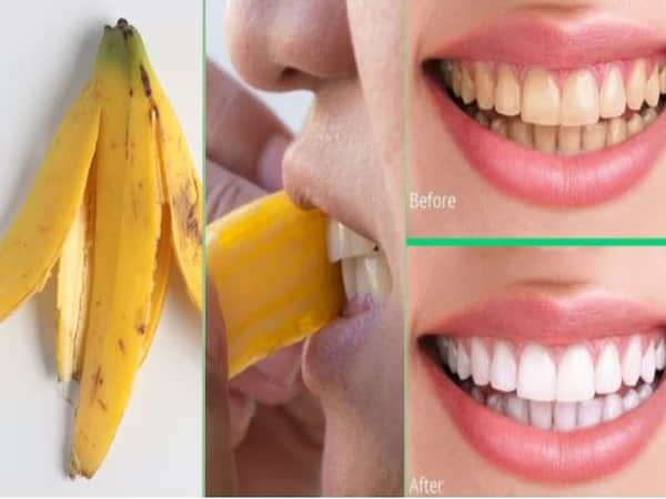 Công dụng của quả chuối trong làm đẹp - vỏ chuối làm trắng răng