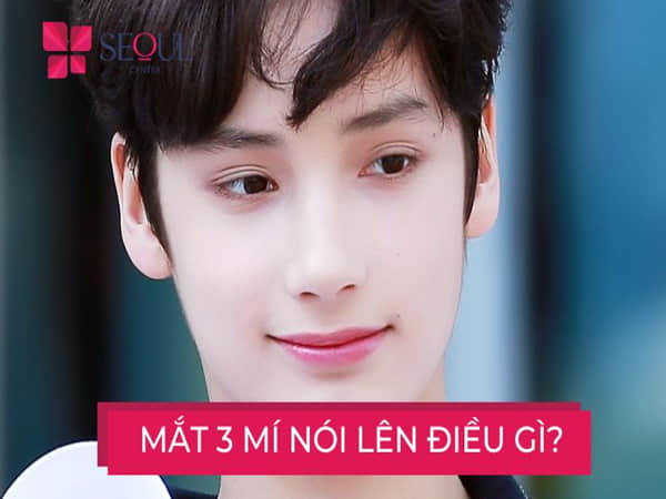 Vận số nam giới có mắt ba mí 