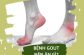 Bị bệnh gout nên ăn gì tốt cho sức khỏe, hỗ trợ điều trị bênh?