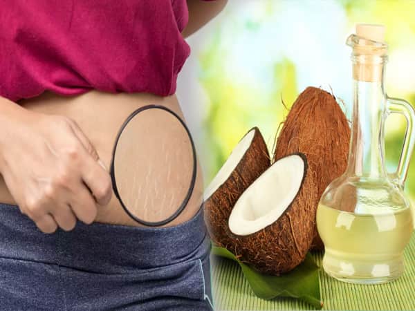 Dầu dừa trị rạn da