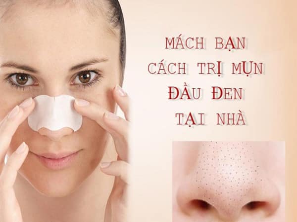 Cách trị mụn đầu đen tại nhà
