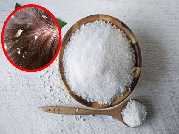 Những lưu ý khi sử dụng muối để trị gàu