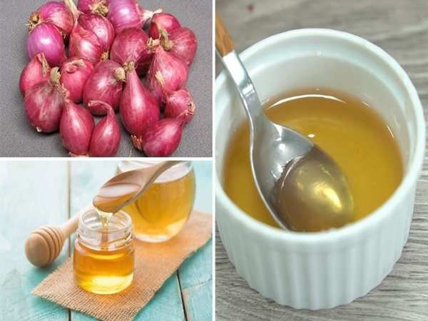 Bài thuốc từ củ hành tím trị viêm họng