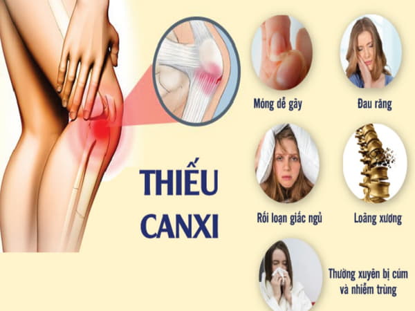 Biểu hiện thiếu canxi ở người lớn dễ nhận biết nhất