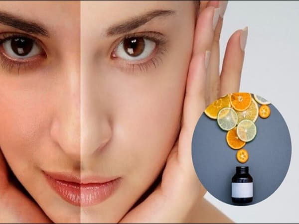 Vitamin C có tác dụng gì với da mặt, cách bổ sung vitamin c cho da mặt