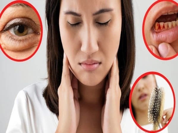 Những biểu hiện thiếu vitamin C