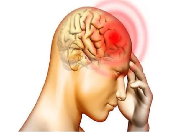 Thiếu máu não là gì? Dấu hiệu nhận biết