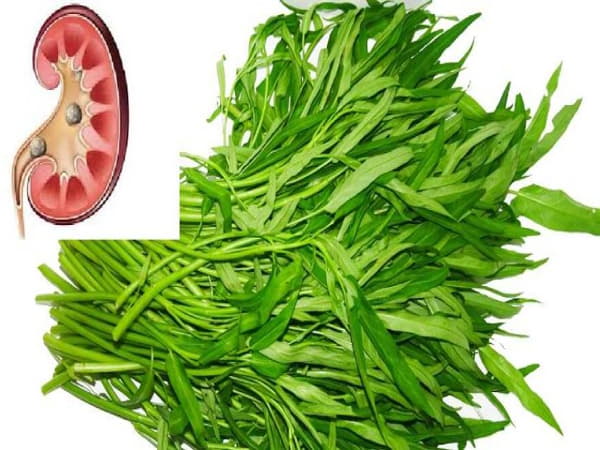 Sỏi thận ăn rau muống được không