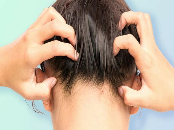 Da đầu nhạy cảm có nên ủ tóc không