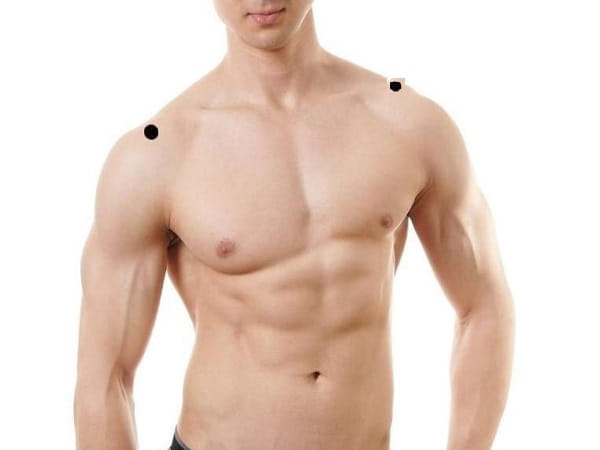 Ý nghĩa mụn ruồi 2 bên vai ở nam giới