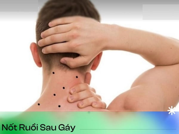 Ý nghĩa chung của nốt ruồi sau gáy