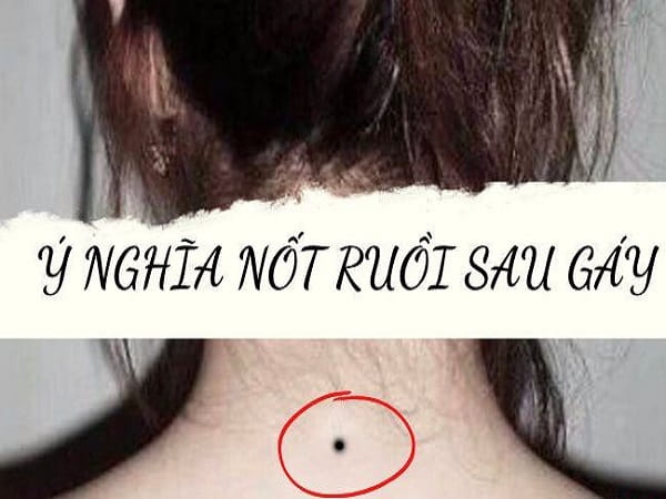 Nốt ruồi sau gáy ở nữ giới