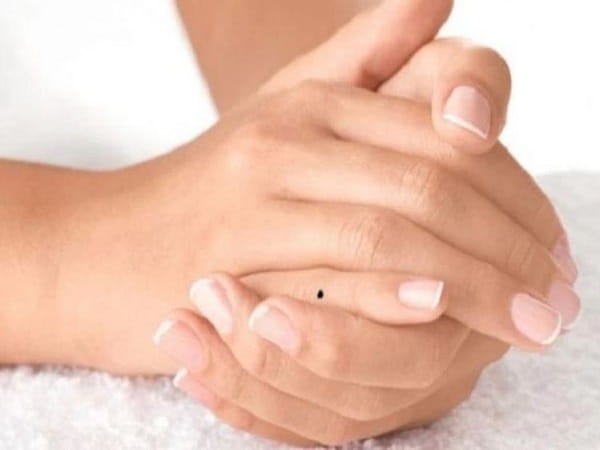 Ý nghĩa chung của mụn ruồi ở ngón tay út trong nhân tướng học